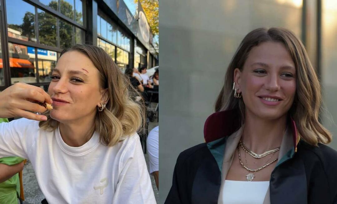 Qu'est-il arrivé au sourcil de Serenay Sarıkaya, dont la nouvelle série numérique est certaine? Déclaration du célèbre acteur